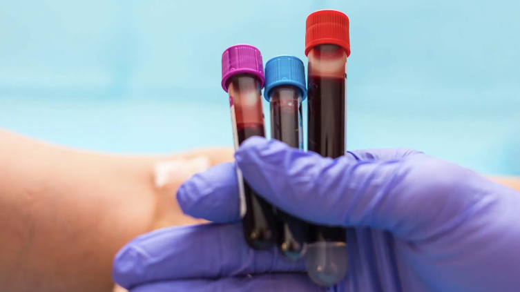 Understanding Blood Transfusion Filters in Modern Healthcare